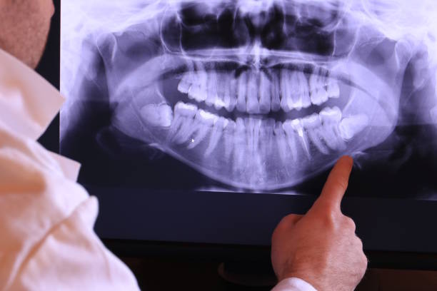 Best Emergency Denture Repair in Dupont, WA