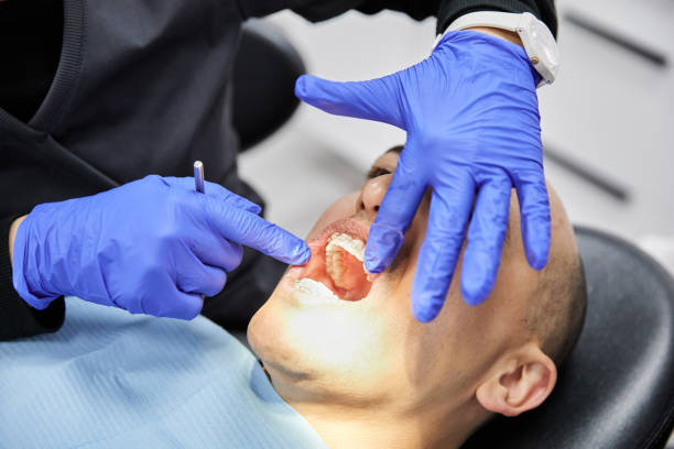Best Emergency Gum Treatment in Dupont, WA